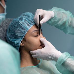 Rhinoplasty